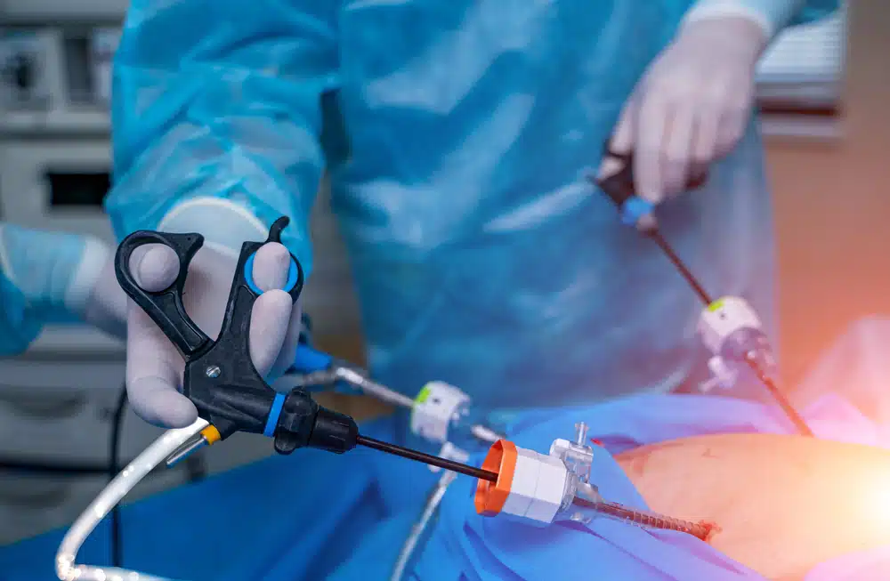 What is Bariatric Surgery: Understanding Preparation, Cost, Recovery